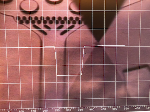 Profilometer-scan of a developed microfluidic-pattern